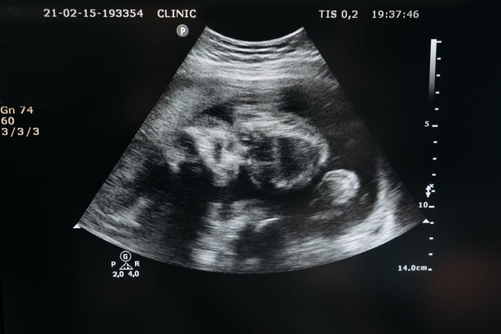 pexels photo 7108416 Ultrasound scan showing the image of an unborn child in the womb, highlighting pregnancy and healthcare.
